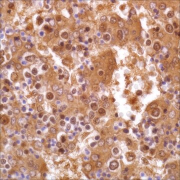 Alpha-Fetoprotein (EP209) Rabbit Monoclonal Primary Antibody