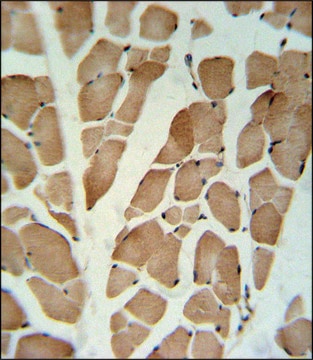 ANTI-GLG1 (C-TERM) antibody produced in rabbit IgG fraction of antiserum, buffered aqueous solution