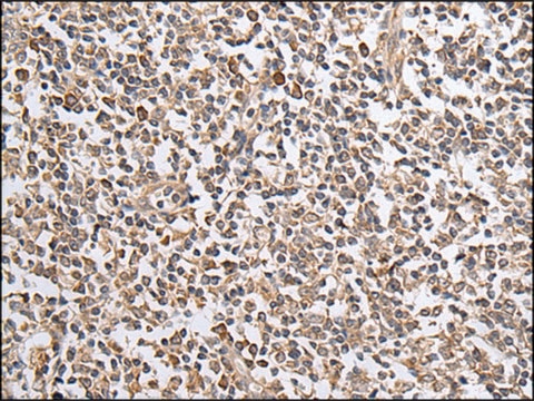 Anti-CXCL1 affinity isolated antibody