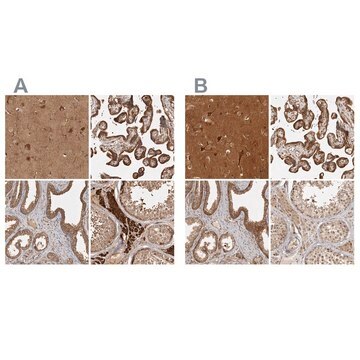 Anti-CAMSAP2 antibody produced in rabbit Prestige Antibodies&#174; Powered by Atlas Antibodies, affinity isolated antibody, buffered aqueous glycerol solution, Ab3