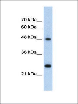 Anti-CHGA (AB2) antibody produced in rabbit IgG fraction of antiserum