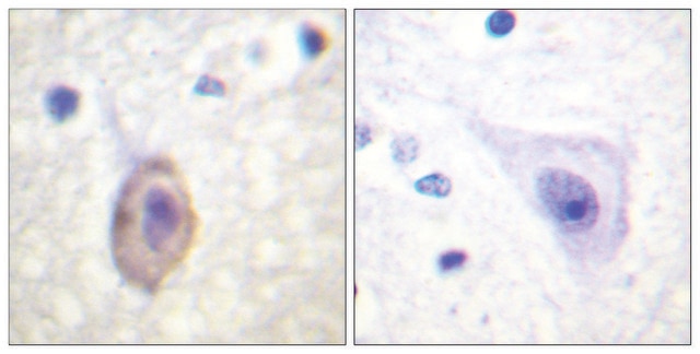 Anti-VEGFR1 antibody produced in rabbit affinity isolated antibody