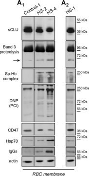 Anti-Human IgG (whole molecule)&#8722;Peroxidase antibody produced in rabbit IgG fraction of antiserum, buffered aqueous solution