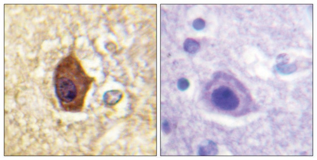 Anti-Synapsin1, antibody produced in rabbit affinity isolated antibody