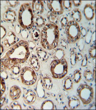 ANTI-CCR1 (N-TERM) antibody produced in rabbit IgG fraction of antiserum, buffered aqueous solution