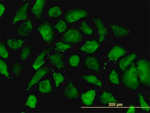 Monoclonal Anti-ANXA2, (C-terminal) antibody produced in mouse clone 1G7, purified immunoglobulin, buffered aqueous solution