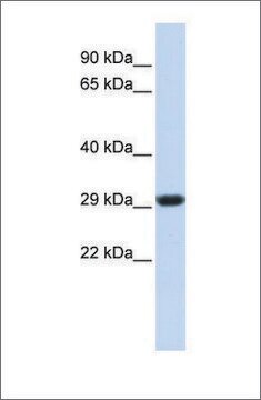 Anti-SDHB antibody produced in rabbit affinity isolated antibody