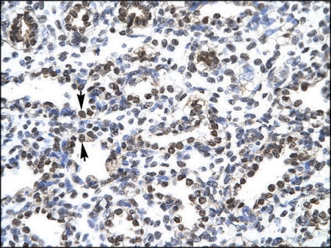 Anti-CIC IgG fraction of antiserum