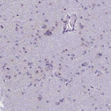 Anti-TMEM206 antibody produced in rabbit Prestige Antibodies&#174; Powered by Atlas Antibodies, affinity isolated antibody, buffered aqueous glycerol solution