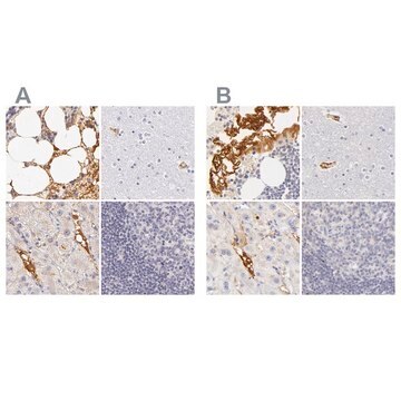 Anti-AHSG antibody produced in rabbit Prestige Antibodies&#174; Powered by Atlas Antibodies, affinity isolated antibody, buffered aqueous glycerol solution