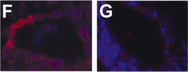 Monoclonal Anti-Actin, &#945;-Smooth Muscle clone 1A4, ascites fluid