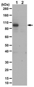 Anti-phospho Glucocorticoid Receptor Antibody (Ser287) from rabbit, purified by affinity chromatography