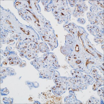 Factor VIII-R Ag. Rabbit Polyclonal Antibody