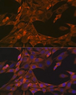 Anti-HE4/WFDC2 antibody produced in rabbit