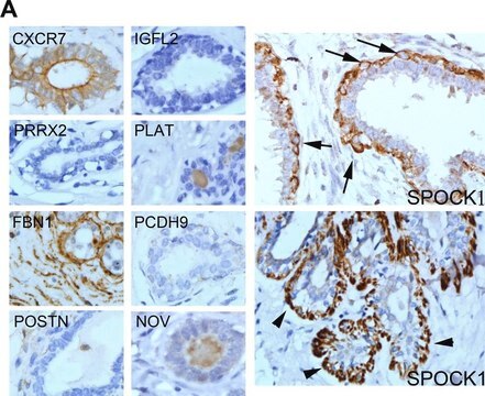 Anti-ACKR3 antibody produced in rabbit Prestige Antibodies&#174; Powered by Atlas Antibodies, affinity isolated antibody, buffered aqueous glycerol solution