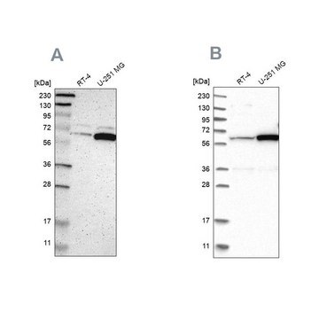 Anti-P4HA1 antibody produced in rabbit Prestige Antibodies&#174; Powered by Atlas Antibodies, affinity isolated antibody, buffered aqueous glycerol solution