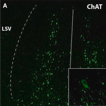 Anti-Choline Acetyltransferase Antibody serum, Chemicon&#174;