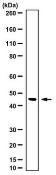 Anti-FANCF Antibody serum, from rabbit