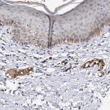 Anti-CCL2 antibody produced in rabbit Prestige Antibodies&#174; Powered by Atlas Antibodies, affinity isolated antibody, buffered aqueous glycerol solution