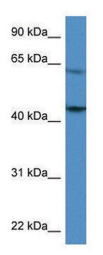 Anti-F2R (C-terminal) antibody produced in rabbit affinity isolated antibody