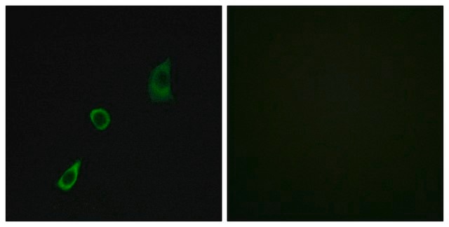 Anti-FGF23 antibody produced in rabbit affinity isolated antibody