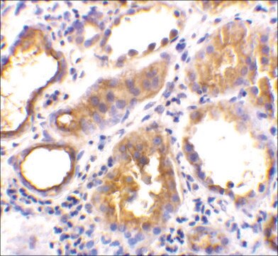 Anti-ACE2 antibody produced in rabbit affinity isolated antibody, buffered aqueous solution