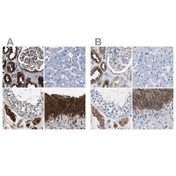 Anti-GSTP1 antibody produced in rabbit Prestige Antibodies&#174; Powered by Atlas Antibodies, affinity isolated antibody, buffered aqueous glycerol solution, Ab1