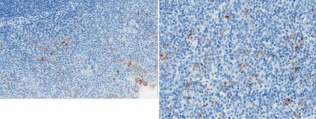 Anti-Properdin Antibody, clone 6E11A4 clone 6E11A4, from mouse