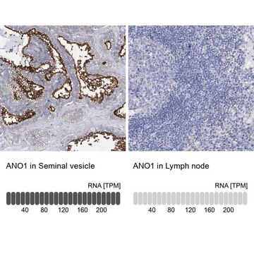 Anti-ANO1 antibody produced in rabbit Prestige Antibodies&#174; Powered by Atlas Antibodies, affinity isolated antibody, buffered aqueous glycerol solution