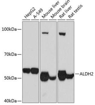 Anti-ALDH2 antibody produced in rabbit