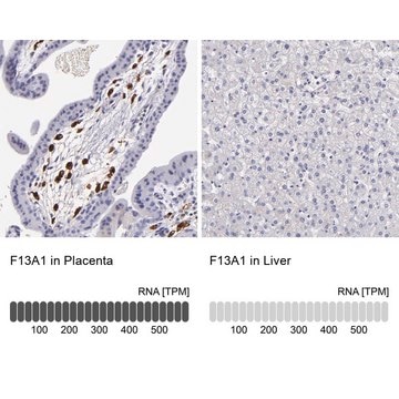 Anti-F13A1 antibody produced in rabbit Prestige Antibodies&#174; Powered by Atlas Antibodies, affinity isolated antibody, buffered aqueous glycerol solution