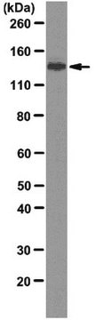 Anti-USP7 Antibody, clone 1G7 clone 1G7, from mouse