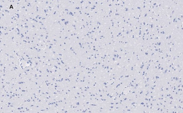 Anti-VGluT1 Antibody, clone 4O15, ZooMAb&#174; Rabbit Monoclonal recombinant, expressed in HEK 293 cells