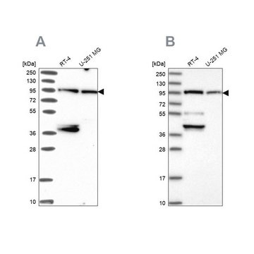 Anti-UBE3A antibody produced in rabbit Prestige Antibodies&#174; Powered by Atlas Antibodies, affinity isolated antibody, buffered aqueous glycerol solution