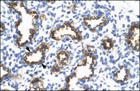 Anti-RFP2 (AB1) antibody produced in rabbit affinity isolated antibody