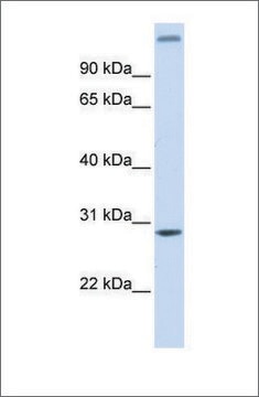 Anti-ALKBH2 antibody produced in rabbit affinity isolated antibody