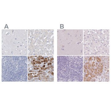 Anti-CTRL antibody produced in rabbit Prestige Antibodies&#174; Powered by Atlas Antibodies, affinity isolated antibody, buffered aqueous glycerol solution