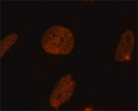 Anti-Methyl-Histone H3 (Me-Lys9)(H3K9me1) antibody, Mouse monoclonal clone 7E7-H12, purified from hybridoma cell culture