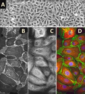 Human Mammary Epithelial Cells: HMEpC, adult