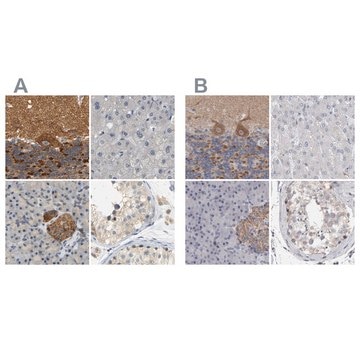 Anti-GDAP1 antibody produced in rabbit Prestige Antibodies&#174; Powered by Atlas Antibodies, affinity isolated antibody, buffered aqueous glycerol solution