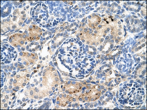 Anti-EDG8 (AB1) antibody produced in rabbit affinity isolated antibody