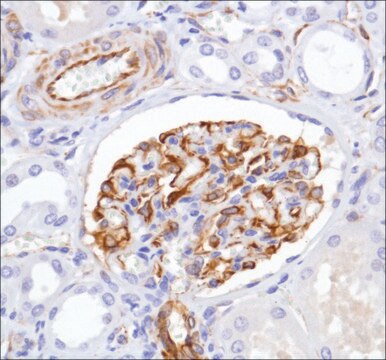 Anti-Nestin antibody, Rabbit monoclonal recombinant, expressed in proprietary host, clone SP103, affinity isolated antibody