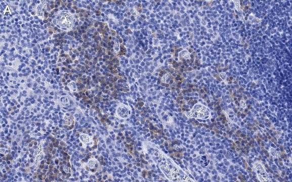 Anti-CD28 Antibody, clone 2N15 ZooMAb&#174; Rabbit Monoclonal recombinant, expressed in HEK 293 cells