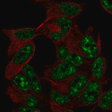 Anti-TADA2A antibody produced in rabbit Prestige Antibodies&#174; Powered by Atlas Antibodies, affinity isolated antibody