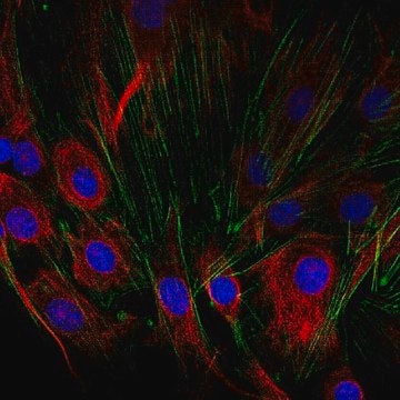 Anti-SCA-1 Antibody from rabbit, purified by affinity chromatography