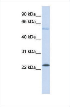 Anti-KRAS affinity isolated antibody