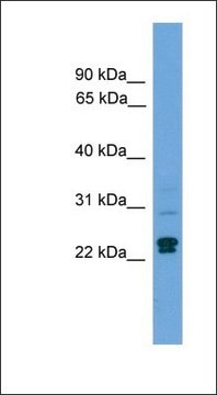 Anti-TP53INP2 antibody produced in rabbit affinity isolated antibody