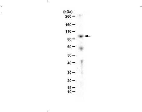 Anti-TDRD3 from rabbit