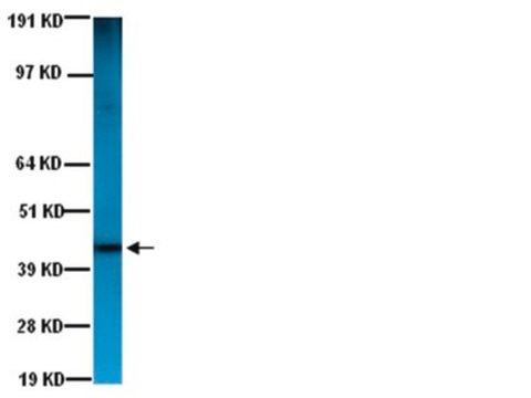 Anti-Actin Antibody, smooth muscle, clone ASM-1 clone ASM-1, Chemicon&#174;, from mouse