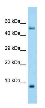 Anti-S100A10 antibody produced in rabbit affinity isolated antibody